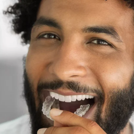 It’s Never Too Late: The Ultimate Guide to Modern Adult Orthodontics in Milwaukee